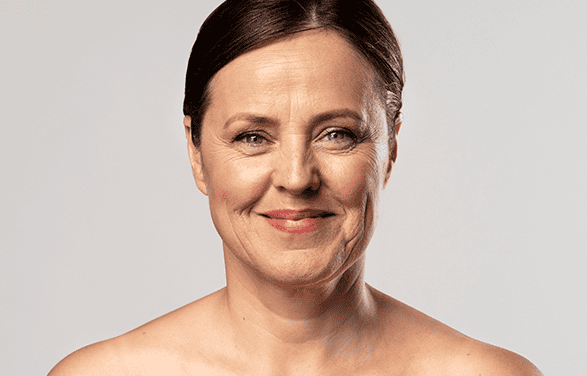 botox Surgery in Ahmedabad
