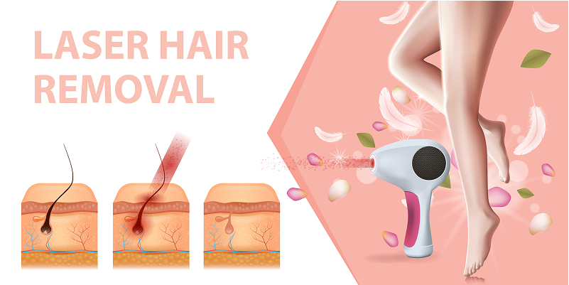 Top 5 Clinics for Laser Hair Removal in Ahmedabad + Cost Comparison